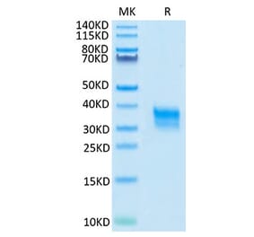 Tris-Bis PAGE - Recombinant Cynomolgus macaque CD32A Protein (C-terminal His Tag) (A331579) - Antibodies.com