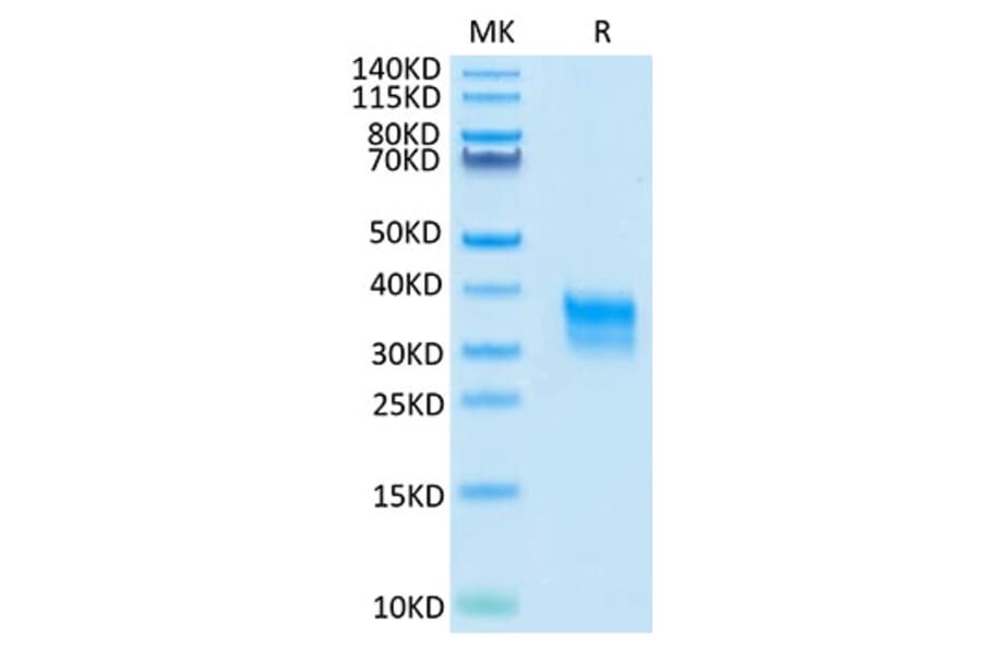 Tris-Bis PAGE - Recombinant Cynomolgus macaque CD32A Protein (C-terminal His Tag) (A331579) - Antibodies.com