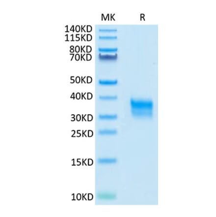 Tris-Bis PAGE - Recombinant Cynomolgus macaque CD32A Protein (C-terminal His Tag) (A331579) - Antibodies.com