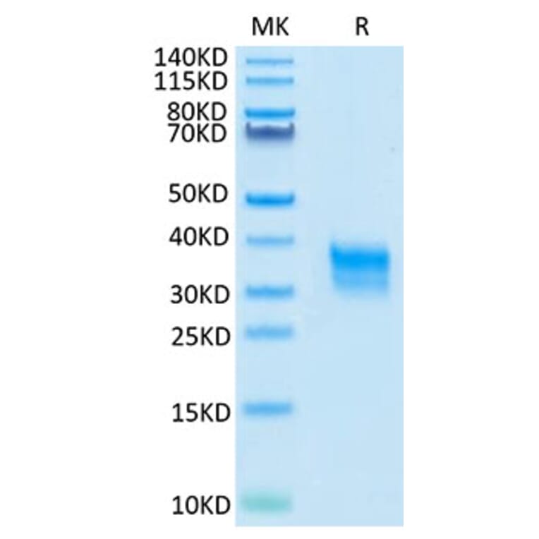 Tris-Bis PAGE - Recombinant Cynomolgus macaque CD32A Protein (C-terminal His Tag) (A331579) - Antibodies.com