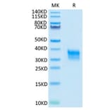 Tris-Bis PAGE - Recombinant Cynomolgus macaque CD32A Protein (C-terminal His Tag) (A331579) - Antibodies.com
