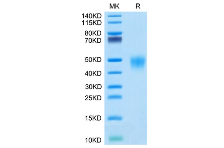 Tris-Bis PAGE - Recombinant Cynomolgus macaque CD16 Protein (C-terminal His Tag) (A331581) - Antibodies.com