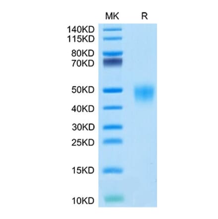 Tris-Bis PAGE - Recombinant Cynomolgus macaque CD16 Protein (C-terminal His Tag) (A331581) - Antibodies.com