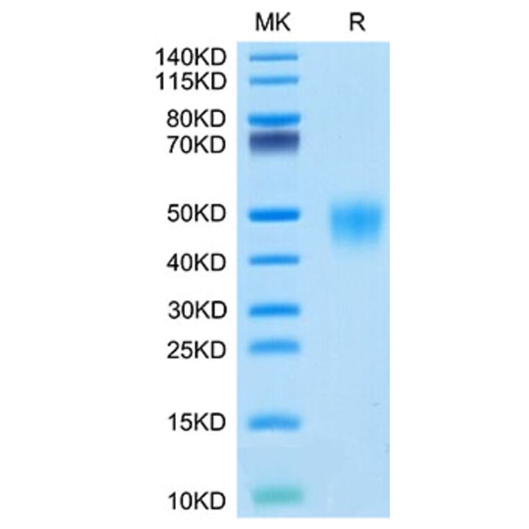 Tris-Bis PAGE - Recombinant Cynomolgus macaque CD16 Protein (C-terminal His Tag) (A331581) - Antibodies.com