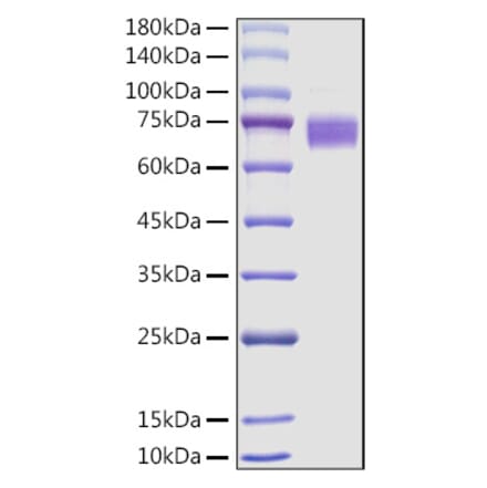 SDS-PAGE - Recombinant Mouse Fc epsilon RI Protein (C-terminal Human Fc Tag) (A331582) - Antibodies.com