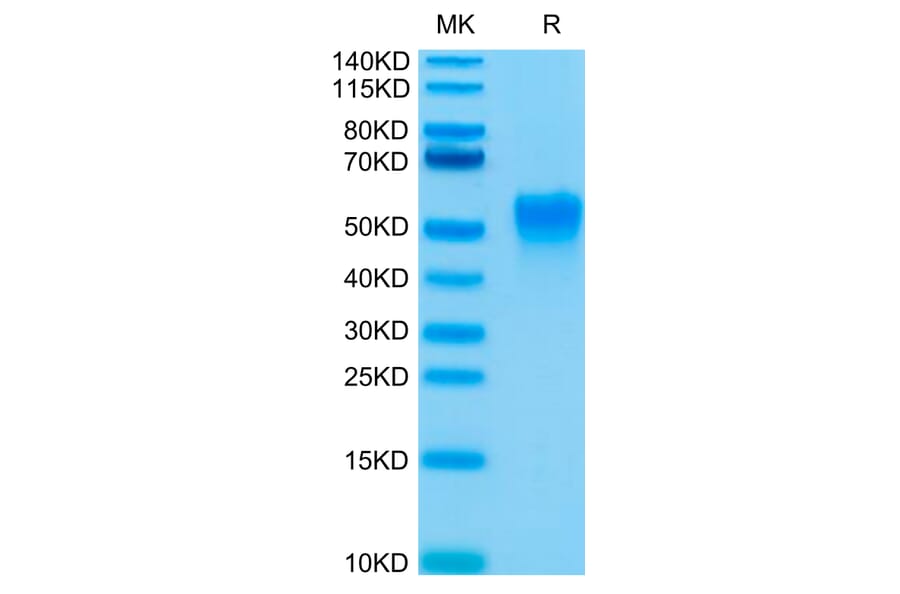 Tris-Bis PAGE - Recombinant Human CD16a Protein (Biotin) (C-terminal His and Avi Tag) (A331583) - Antibodies.com