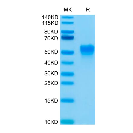 Tris-Bis PAGE - Recombinant Human CD16a Protein (Biotin) (C-terminal His and Avi Tag) (A331583) - Antibodies.com