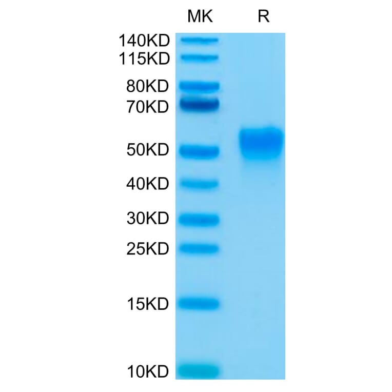 Tris-Bis PAGE - Recombinant Human CD16a Protein (Biotin) (C-terminal His and Avi Tag) (A331583) - Antibodies.com
