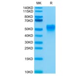 Tris-Bis PAGE - Recombinant Human CD16a Protein (Biotin) (C-terminal His and Avi Tag) (A331583) - Antibodies.com