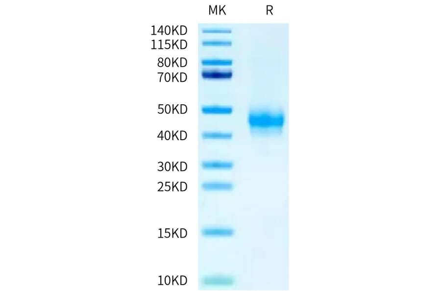 Tris-Bis PAGE - Recombinant Human CD16a Protein (C-terminal Mouse Fc Tag) (A331584) - Antibodies.com
