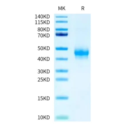Tris-Bis PAGE - Recombinant Human CD16a Protein (C-terminal Mouse Fc Tag) (A331584) - Antibodies.com