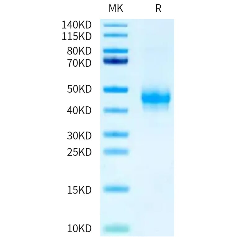 Tris-Bis PAGE - Recombinant Human CD16a Protein (C-terminal Mouse Fc Tag) (A331584) - Antibodies.com
