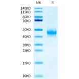 Tris-Bis PAGE - Recombinant Human CD16a Protein (C-terminal Mouse Fc Tag) (A331584) - Antibodies.com