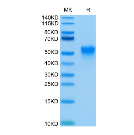 Tris-Bis PAGE - Recombinant Human CD16a Protein (C-terminal His and Avi Tag) (A331585) - Antibodies.com
