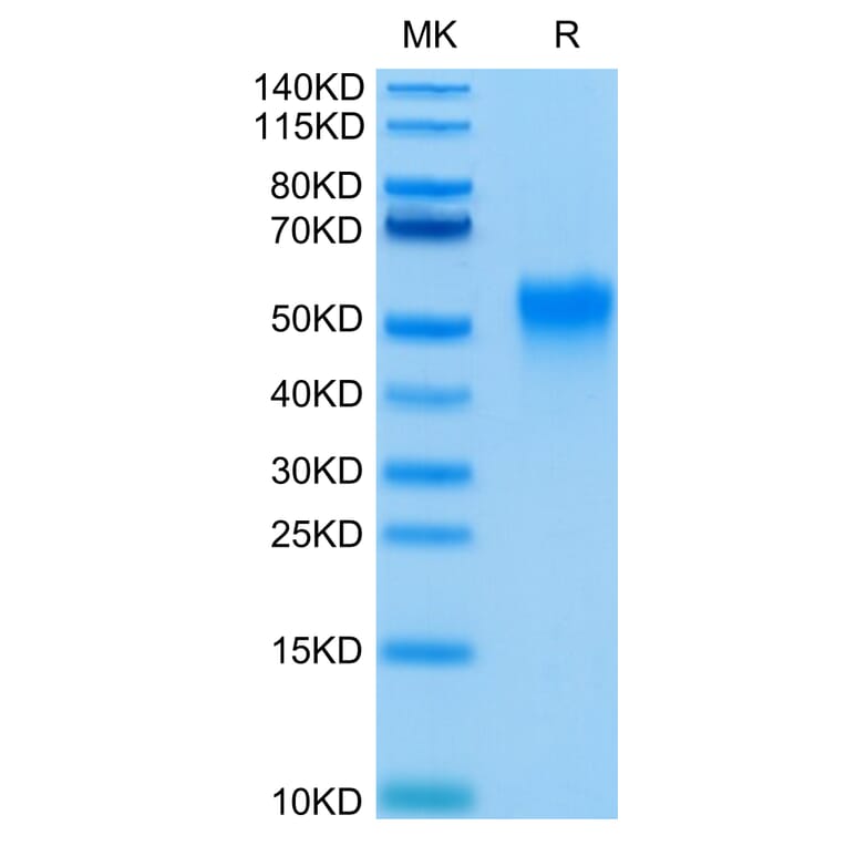 Tris-Bis PAGE - Recombinant Human CD16a Protein (C-terminal His and Avi Tag) (A331585) - Antibodies.com