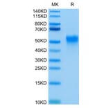 Tris-Bis PAGE - Recombinant Human CD16a Protein (C-terminal His and Avi Tag) (A331585) - Antibodies.com