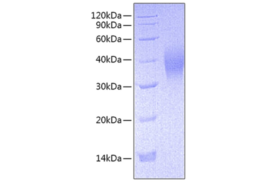 SDS-PAGE - Recombinant Mouse CD16 Protein (C-terminal His Tag) (A331586) - Antibodies.com