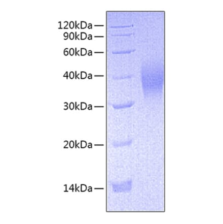 SDS-PAGE - Recombinant Mouse CD16 Protein (C-terminal His Tag) (A331586) - Antibodies.com