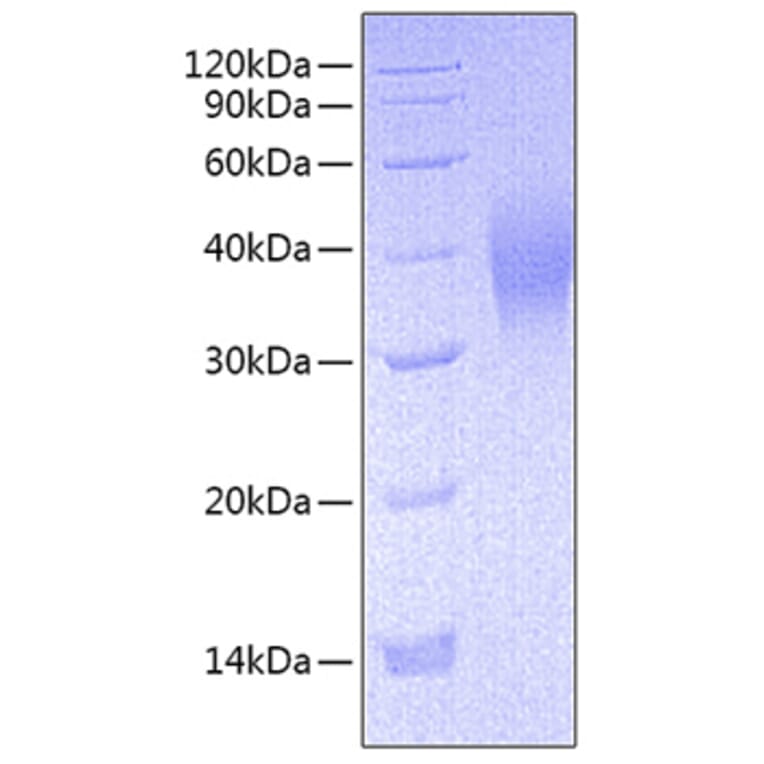 SDS-PAGE - Recombinant Mouse CD16 Protein (C-terminal His Tag) (A331586) - Antibodies.com