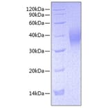 SDS-PAGE - Recombinant Mouse CD16 Protein (C-terminal His Tag) (A331586) - Antibodies.com