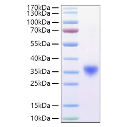 SDS-PAGE - Recombinant Mouse CD16a Protein (C-terminal His Tag) (A331587) - Antibodies.com