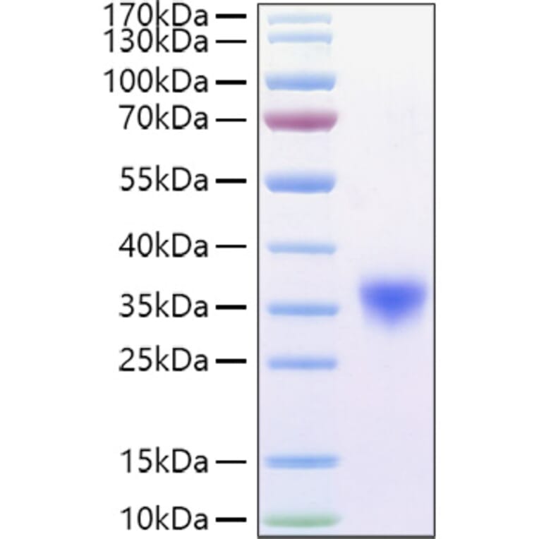 SDS-PAGE - Recombinant Mouse CD16a Protein (C-terminal His Tag) (A331587) - Antibodies.com