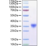 SDS-PAGE - Recombinant Mouse CD16a Protein (C-terminal His Tag) (A331587) - Antibodies.com