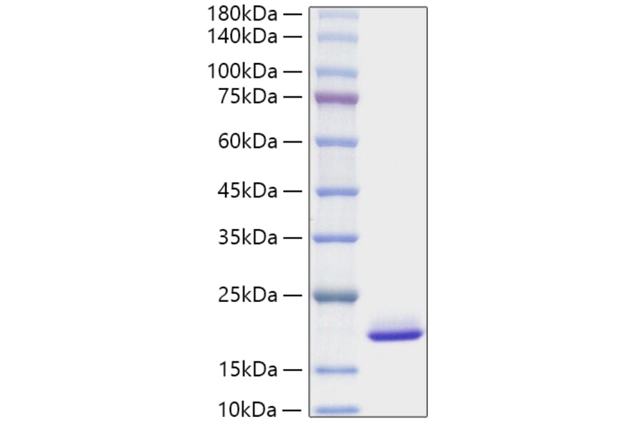 SDS-PAGE - Recombinant Mouse FGF1 Protein (A331589) - Antibodies.com