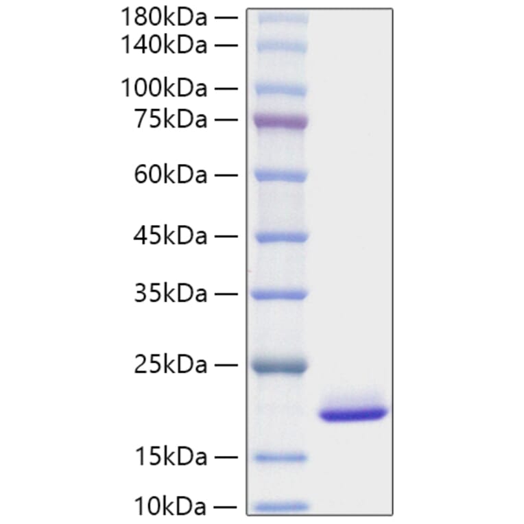 SDS-PAGE - Recombinant Mouse FGF1 Protein (A331589) - Antibodies.com