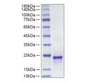 SDS-PAGE - Recombinant Mouse FGF10 Protein (A331590) - Antibodies.com
