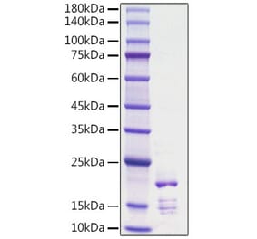 SDS-PAGE - Recombinant Rat FGF2 Protein (C-terminal His Tag) (A331591) - Antibodies.com