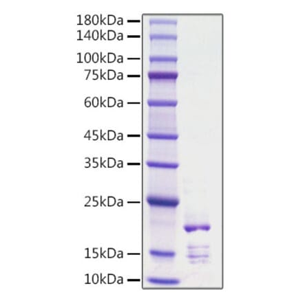 SDS-PAGE - Recombinant Rat FGF2 Protein (C-terminal His Tag) (A331591) - Antibodies.com