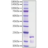SDS-PAGE - Recombinant Rat FGF2 Protein (C-terminal His Tag) (A331591) - Antibodies.com