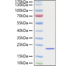 SDS-PAGE - Recombinant Mouse FGF2 Protein (C-terminal His Tag) (A331592) - Antibodies.com