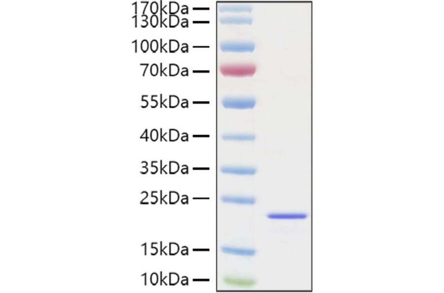 SDS-PAGE - Recombinant Mouse FGF2 Protein (C-terminal His Tag) (A331592) - Antibodies.com