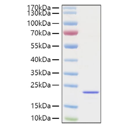 SDS-PAGE - Recombinant Mouse FGF2 Protein (C-terminal His Tag) (A331592) - Antibodies.com