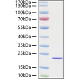 SDS-PAGE - Recombinant Mouse FGF2 Protein (C-terminal His Tag) (A331592) - Antibodies.com
