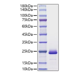 SDS-PAGE - Recombinant Mouse FGF21 Protein (C-terminal His Tag) (A331593) - Antibodies.com