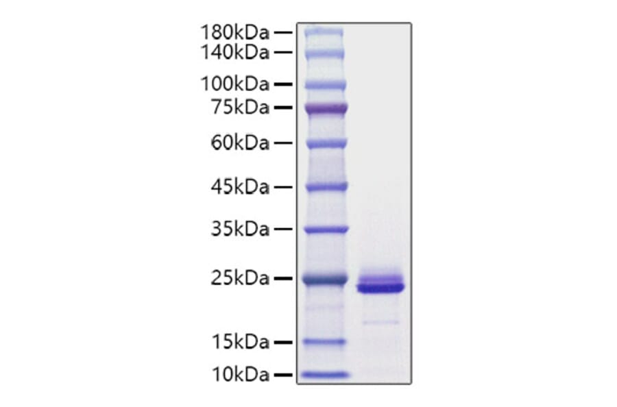 SDS-PAGE - Recombinant Mouse FGF21 Protein (C-terminal His Tag) (A331593) - Antibodies.com