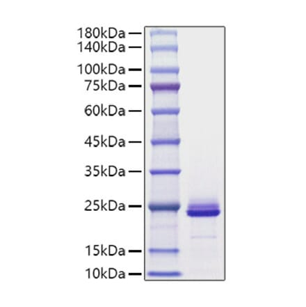 SDS-PAGE - Recombinant Mouse FGF21 Protein (C-terminal His Tag) (A331593) - Antibodies.com