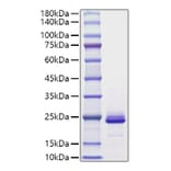 SDS-PAGE - Recombinant Mouse FGF21 Protein (C-terminal His Tag) (A331593) - Antibodies.com