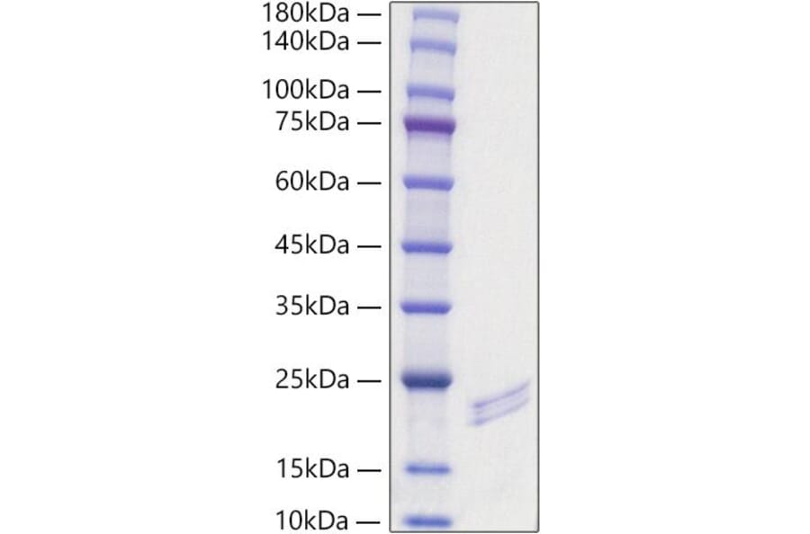 SDS-PAGE - Recombinant Mouse FGF6 Protein (A331594) - Antibodies.com