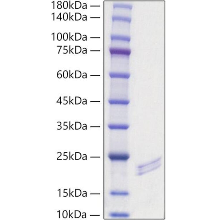 SDS-PAGE - Recombinant Mouse FGF6 Protein (A331594) - Antibodies.com