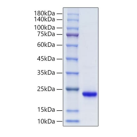 SDS-PAGE - Recombinant Mouse KGF Protein (A331595) - Antibodies.com