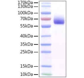 SDS-PAGE - Recombinant Mouse FGFR1 Protein (C-terminal His Tag) (A331596) - Antibodies.com