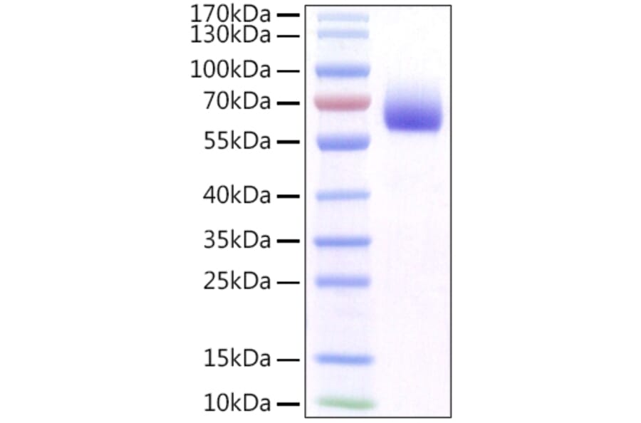 SDS-PAGE - Recombinant Mouse FGFR1 Protein (C-terminal His Tag) (A331596) - Antibodies.com