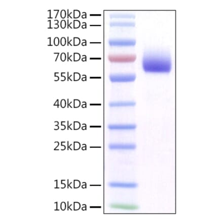 SDS-PAGE - Recombinant Mouse FGFR1 Protein (C-terminal His Tag) (A331596) - Antibodies.com