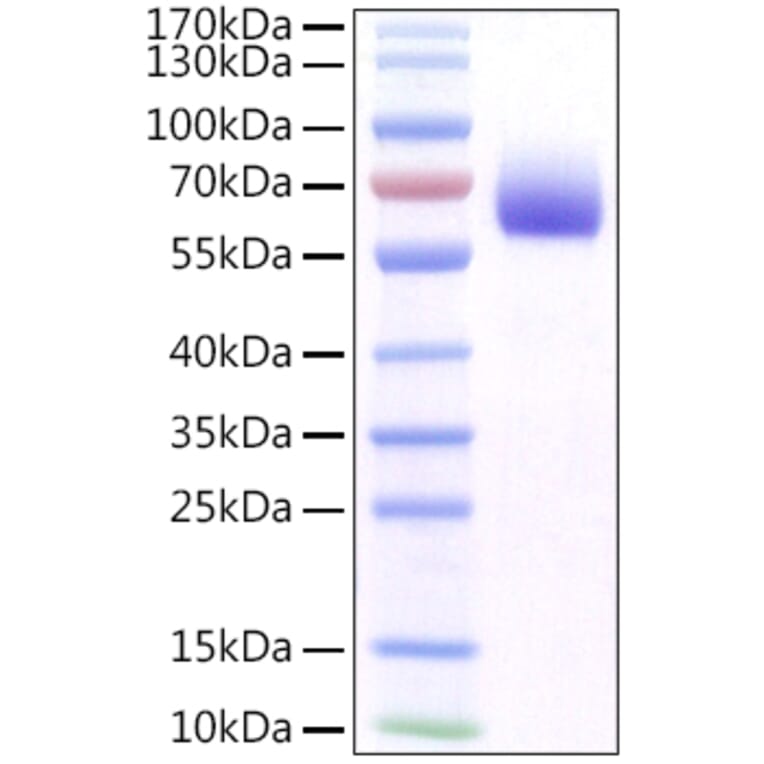 SDS-PAGE - Recombinant Mouse FGFR1 Protein (C-terminal His Tag) (A331596) - Antibodies.com