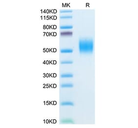 Tris-Bis PAGE - Recombinant Mouse CD332 Protein (C-terminal His Tag) (A331597) - Antibodies.com