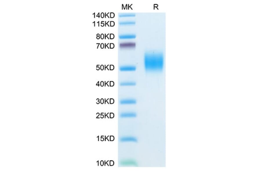 Tris-Bis PAGE - Recombinant Mouse CD332 Protein (C-terminal His Tag) (A331597) - Antibodies.com